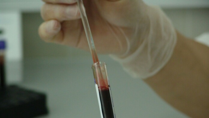 How DNA Technology Will Hurt Your Privacy