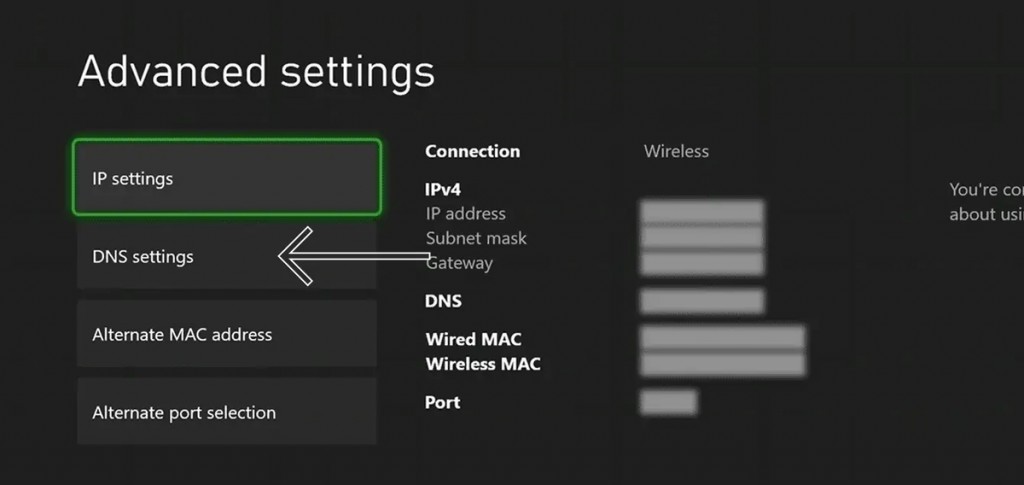 DNS Settings Xbox